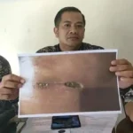Ini Tanggapan Pihak RSMH Palembang Terkait Kasus Pasien Usus Buntu